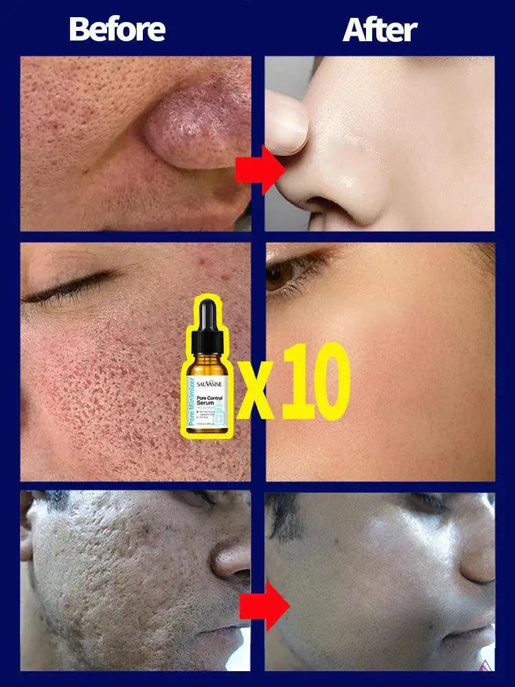 Pore Minimizing Serum for Flawless Radiance and Glow
