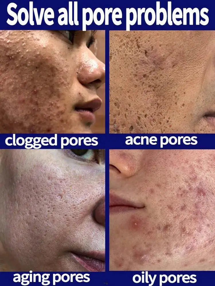 Pore Minimizing Serum for Flawless Radiance and Glow