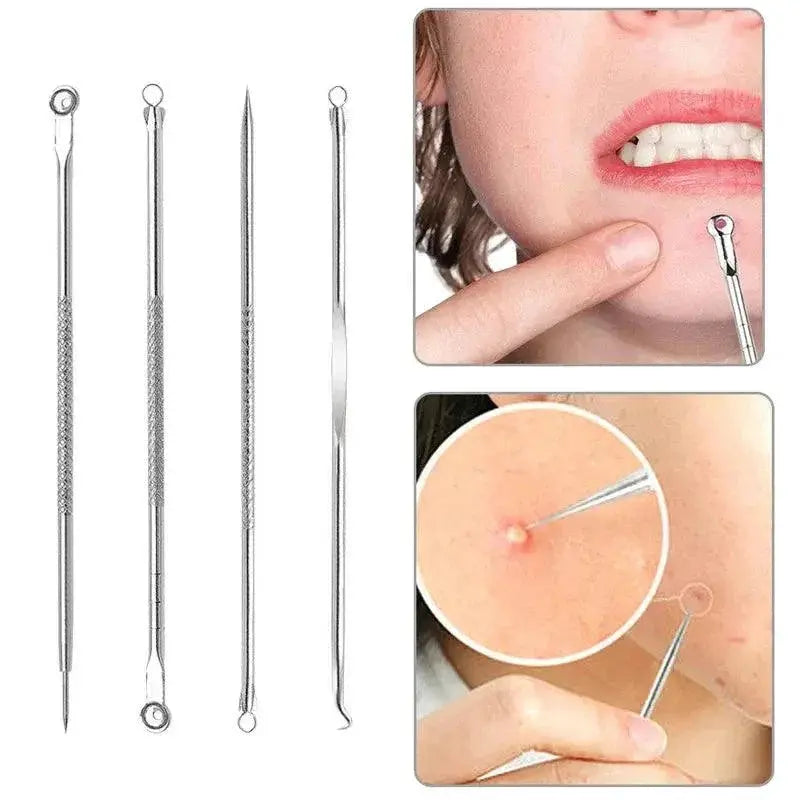 Pore Perfection Blackhead Removal Tool Set For Clear Skin