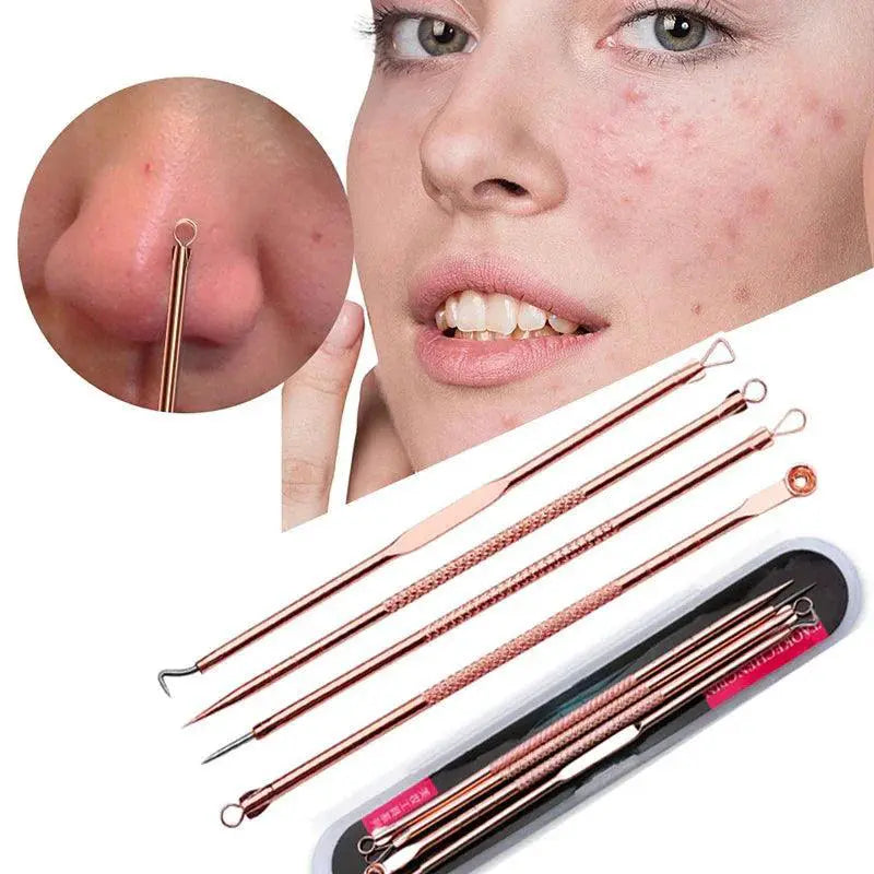 Pore Perfection Blackhead Removal Tool Set For Clear Skin