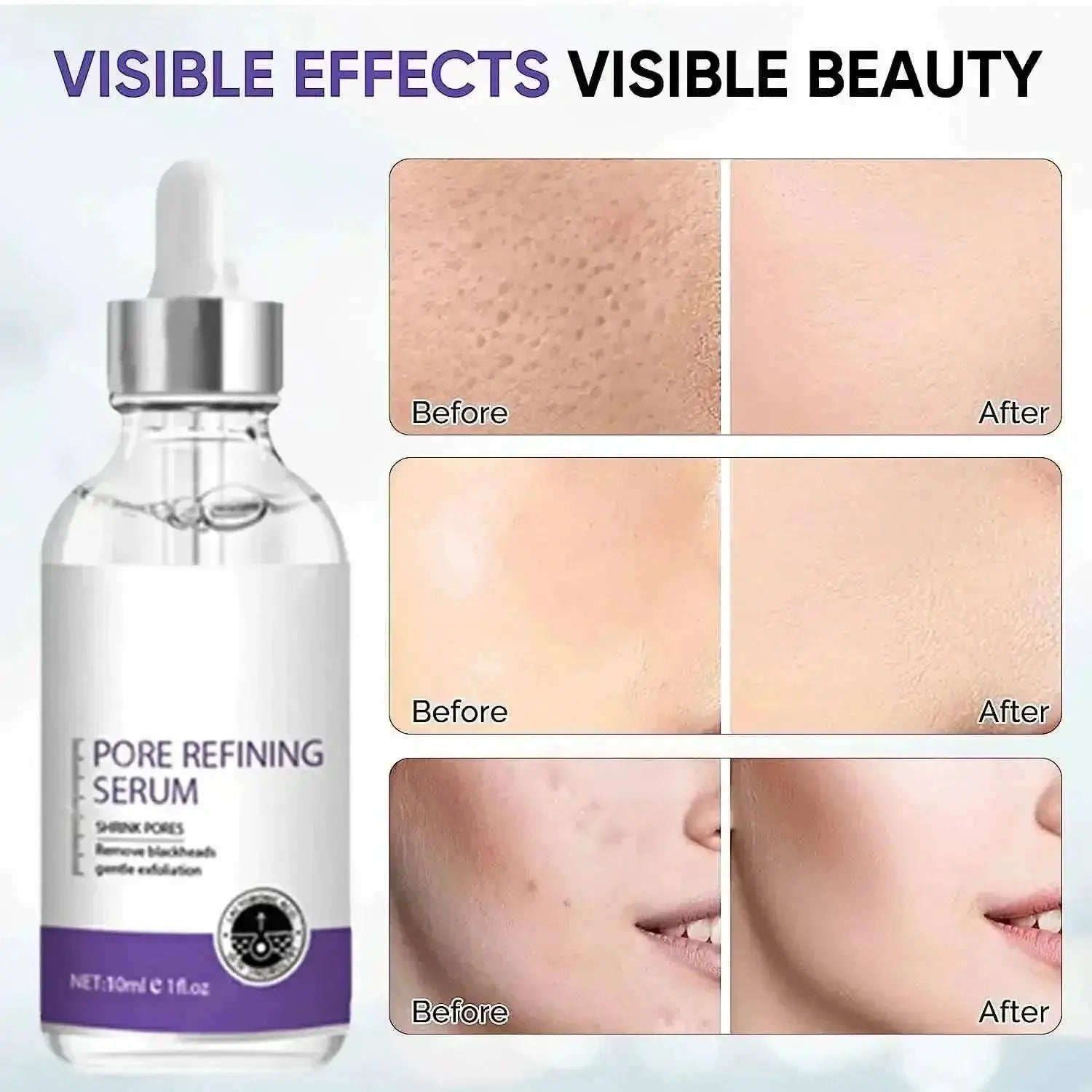 Pore Refining Essence Clear Pores And Repair Skin Now