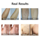 Pain Free IPL Hair Removal For Women