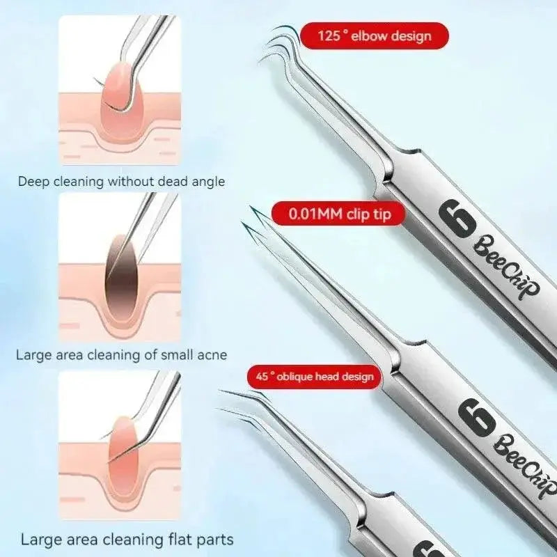 Precision Blackhead Removal Kit Clear Skin Tweezers
