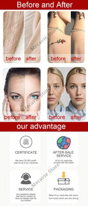 Precision Diode Pico Laser For Hair