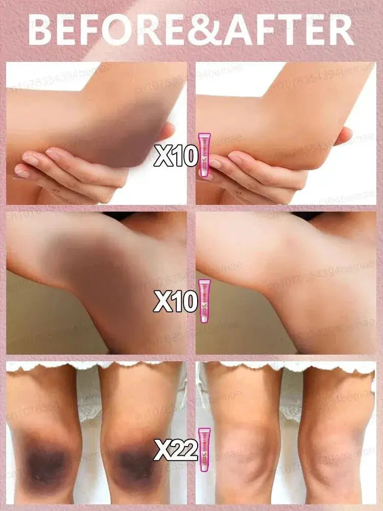 Private Area Brightening Serum For Even Skin Tone Confidence