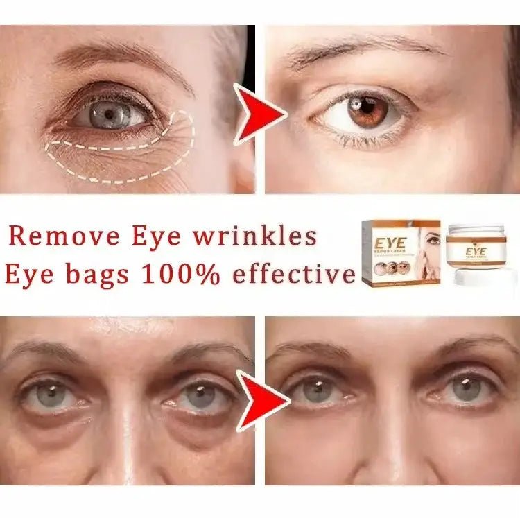 Puffy Eye Cream For Brighter Under Eyes