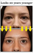 Puffy Eye Cream For Brighter Under Eyes