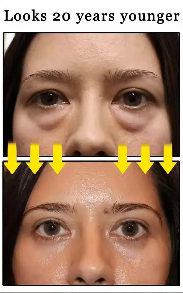 Puffy Eye Cream For Brighter Under Eyes