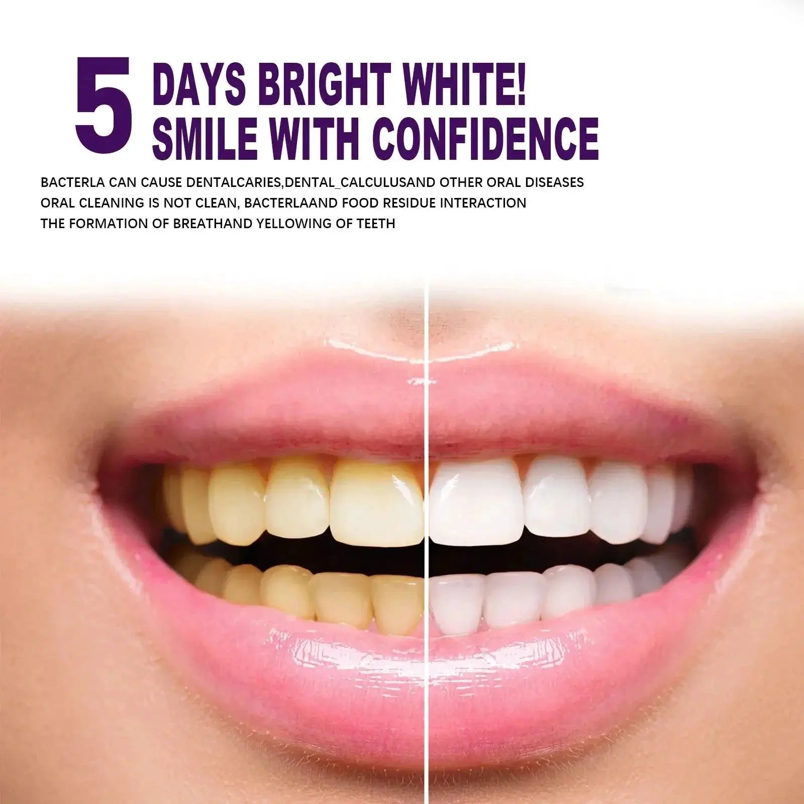 Purple Mint Infusion Teeth Whitening Toothpaste Max Strength