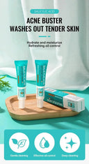PWYUMAN Acne Cream for Acne Prone Skin