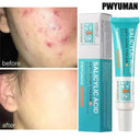 PWYUMAN Acne Cream for Acne Prone Skin