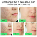 PWYUMAN Acne Cream for Acne Prone Skin