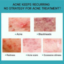 PWYUMAN Acne Cream for Acne Prone Skin