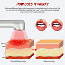 Red Light Wand For Cold Sores Healing