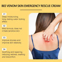 Redness Relief Cream for Sensitive Skin