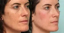 Retinol Cream for Women Anti-Aging Daily
