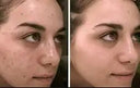 Retinol Cream for Women Anti-Aging Daily