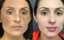 Retinol Cream for Women Anti-Aging Daily