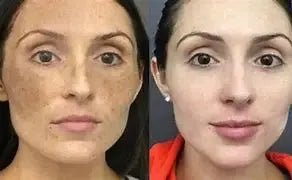 Retinol Cream for Women Anti-Aging Daily