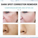 Retinol Cream for Women Anti-Aging Daily