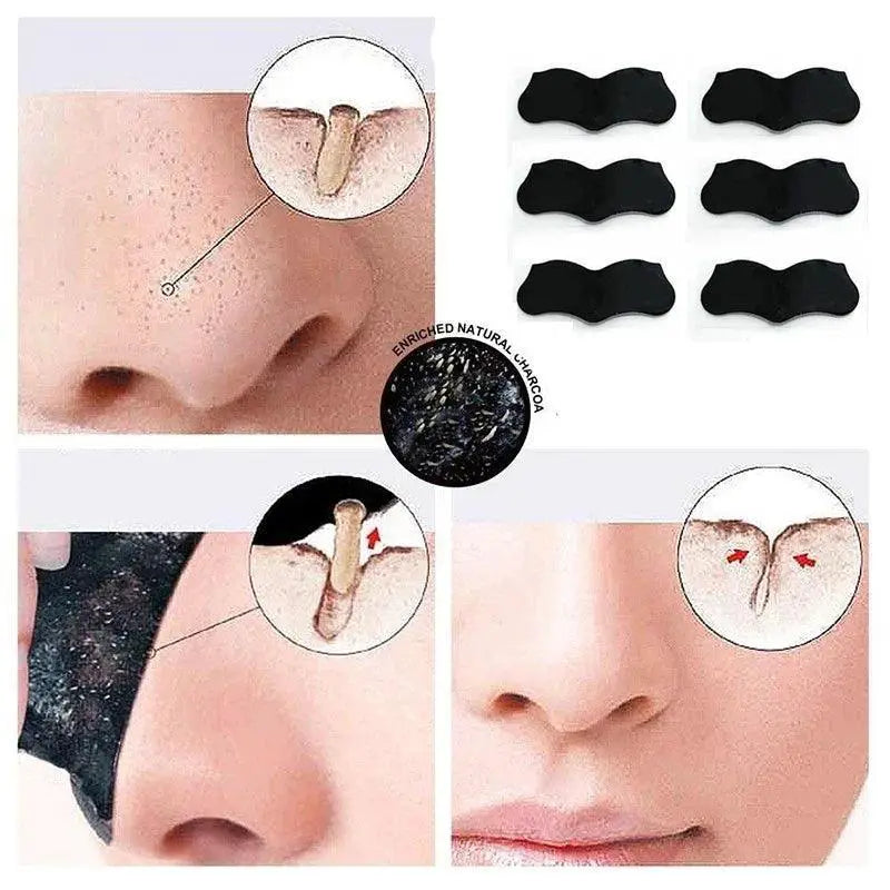 Rose Gold Blackhead Removal Kit Professional Skincare Set