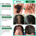 Boosts Hair Growth Oil for Hair Loss