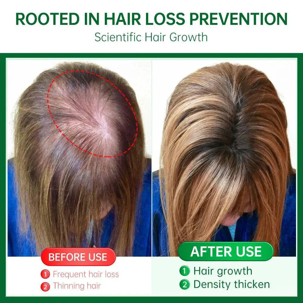 Rosemary Ginger Hair Growth Oil For Hair Loss Solution - OurLum.com