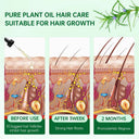 Boosts Hair Growth Oil for Hair Loss