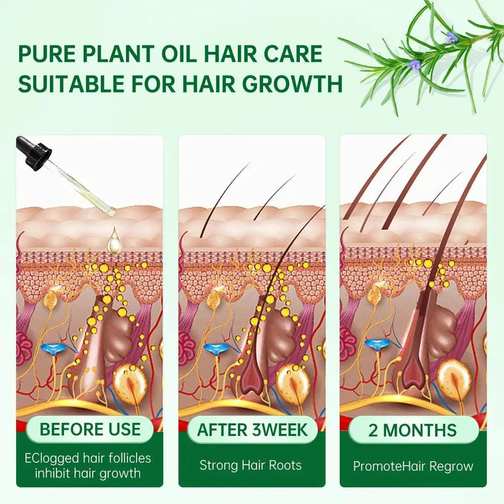 Rosemary Ginger Hair Growth Oil For Hair Loss Solution - OurLum.com