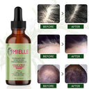 Hair Growth Oil for All Hair Types Shine