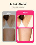 Safe IPL Hair Removal Device for Women