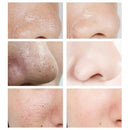 Salicylic Serum for Oily Skin and Pores