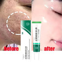 Salicylic Serum for Oily Skin and Pores