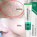 Salicylic Serum for Oily Skin and Pores
