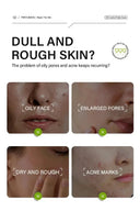 Salicylic Serum for Oily Skin and Pores