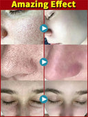 Salicylic Serum for Oily Skin and Pores