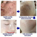 Salicylic Serum for Oily Skin and Pores