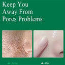 Salicylic Serum for Oily Skin and Pores