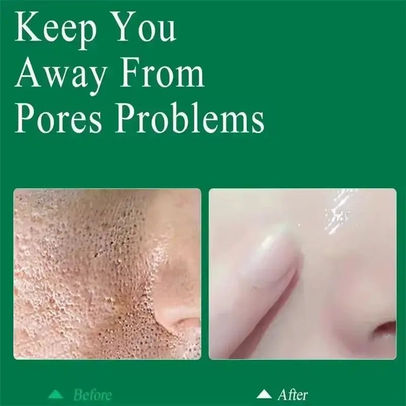 Salicylic Serum for Oily Skin and Pores — product view 20
