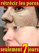 Salicylic Serum for Oily Skin and Pores