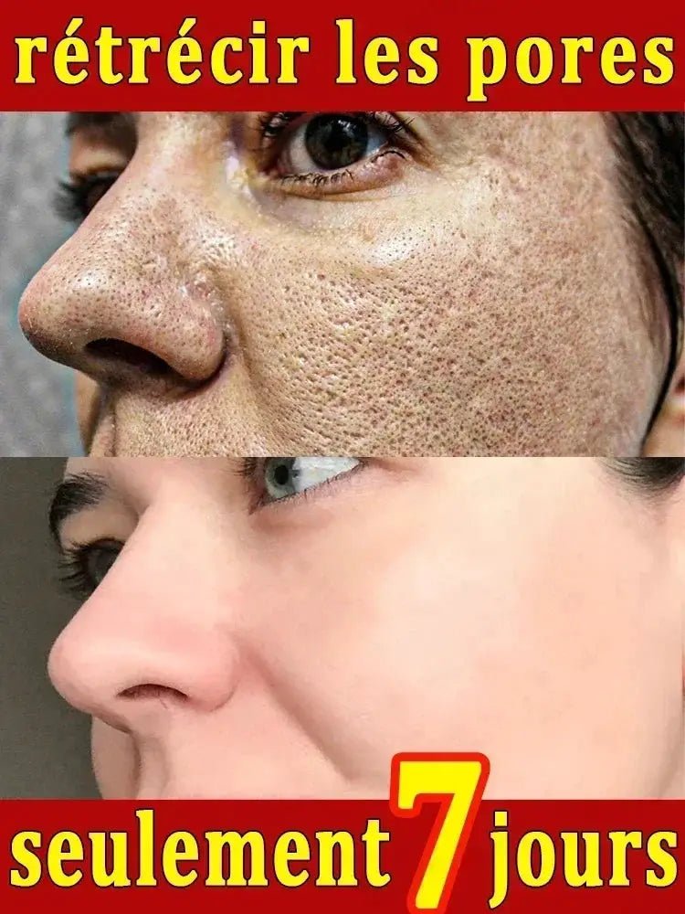 Salicylic Serum for Oily Skin and Pores