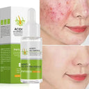Salicylic Serum for Oily Skin and Pores