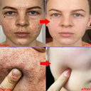 Salicylic Serum for Oily Skin and Pores