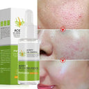 Salicylic Serum for Oily Skin and Pores