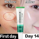Salicylic Serum for Oily Skin and Pores