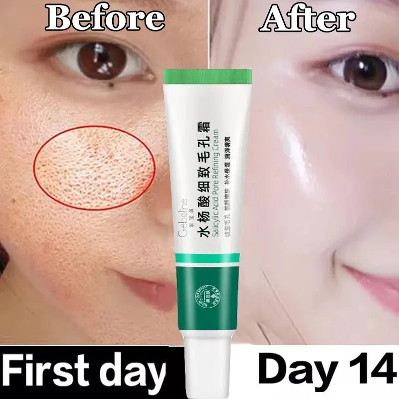 Salicylic Serum for Oily Skin and Pores