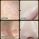 Salicylic Serum for Oily Skin and Pores