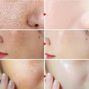 Salicylic Serum for Oily Skin and Pores