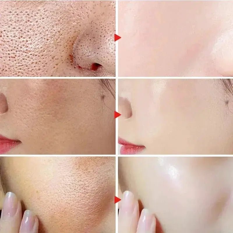 Salicylic Serum for Oily Skin and Pores
