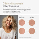 Salon Grade IPL Hair Remover Smooth Skin